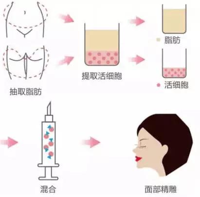 data-cke-saved-src=http___s8.sinaimg.cn_mw690_006WU2akzy7h3GTvhcPd7&690&refer=http___s8.sinaimg.jpg src=http___s8.sinaimg.cn_mw690_006WU2akzy7h3GTvhcPd7&690&refer=http___s8.sinaimg.jpg