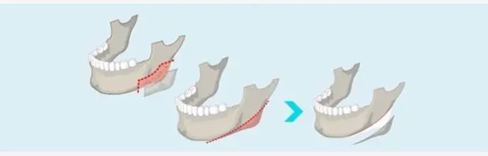 1625204828350938.jpg u=2812709404,277134310&fm=26&fmt=auto&gp=0.jpg